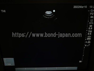 Color Doppler&nbsp;|&nbsp;SonoSite&nbsp;|&nbsp;M-Turbo