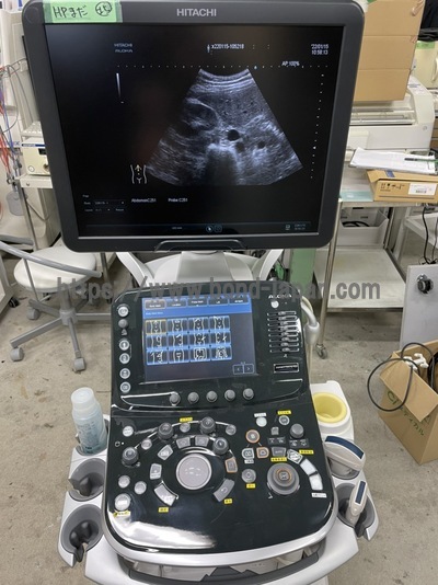 超音波診断装置&nbsp;|&nbsp;富士フイルムメディカル株式会社&nbsp;|&nbsp;ARIETTA S70の写真