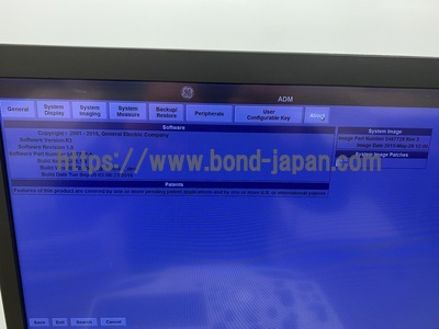 超音波診断装置/カラードプラ&nbsp;|&nbsp;GEヘルスケア・ジャパン株式会社&nbsp;|&nbsp;Logiq S8 XDclearの写真