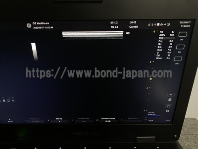 超音波診断装置&nbsp;|&nbsp;GEヘルスケア・ジャパン株式会社&nbsp;|&nbsp;Versana Activeの写真