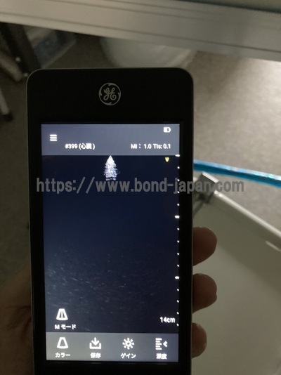 汎用超音波画像診断装置&nbsp;|&nbsp;GEヘルスケア・ジャパン株式会社&nbsp;|&nbsp;Vscan Extend R2の写真