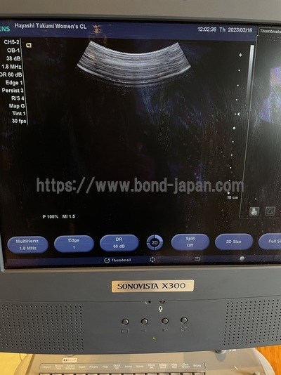 Color Doppler&nbsp;|&nbsp;SIEMENS&nbsp;|&nbsp;X300