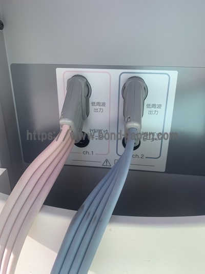 干渉波治療器&nbsp;|&nbsp;オージー技研株式会社&nbsp;|&nbsp;EF-150の写真