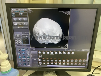 CT Scanner&nbsp;|&nbsp;CANON&nbsp;|&nbsp;Alexion 16