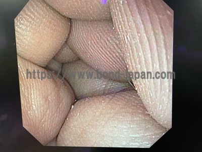 上部消化管用ビデオスコープ&nbsp;|&nbsp;オリンパス&nbsp;|&nbsp;GIF-XP170Nの写真