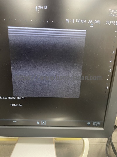 超音波診断装置&nbsp;|&nbsp;日立製作所&nbsp;|&nbsp;ARIETTA 60の写真