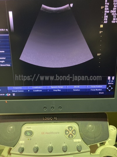 Color Doppler&nbsp;|&nbsp;GE&nbsp;|&nbsp;LOGIQ P6