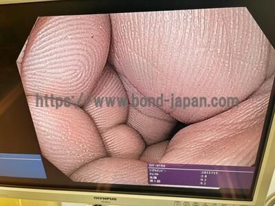 Endoscopy System&nbsp;|&nbsp;OLYMPUS&nbsp;|&nbsp;CV-190 PLUS