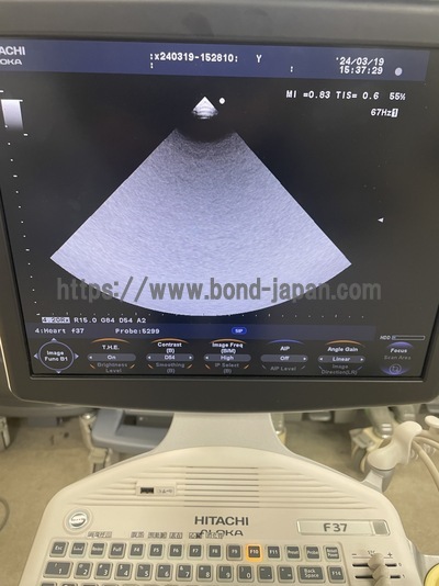 Color Doppler&nbsp;|&nbsp;HITACHI&nbsp;|&nbsp;F37
