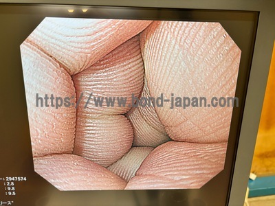 Video Gastroscope&nbsp;|&nbsp;OLYMPUS&nbsp;|&nbsp;GIF-H260