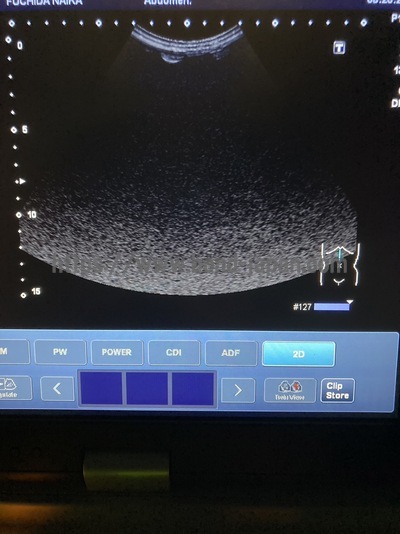 Color Doppler&nbsp;|&nbsp;CANON&nbsp;|&nbsp;Viamo SSA-640A