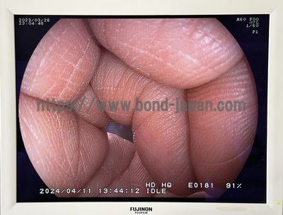 Gastroscope&nbsp;|&nbsp;FUJIFILM&nbsp;|&nbsp;EG-590WR