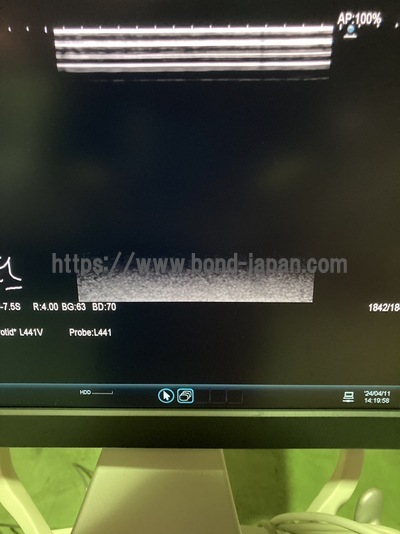 Ultrasound System&nbsp;|&nbsp;HITACHI&nbsp;|&nbsp;ARIETTA 60