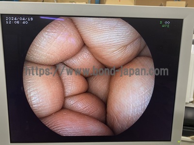 Endoscopy System&nbsp;|&nbsp;FUJIFILM&nbsp;|&nbsp;EPX-3200(2500)