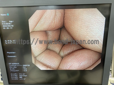 Endoscopy System&nbsp;|&nbsp;OLYMPUS&nbsp;|&nbsp;LUCERA CV-260SL