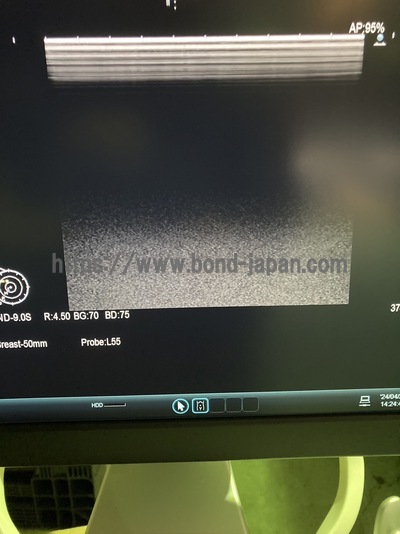 超音波診断装置&nbsp;|&nbsp;日立製作所&nbsp;|&nbsp;ARIETTA 60の写真