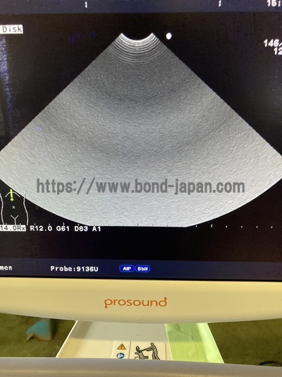 Color Doppler&nbsp;|&nbsp;HITACHI&nbsp;|&nbsp;Prosound α6