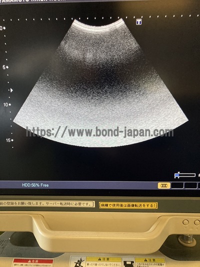 Color Doppler&nbsp;|&nbsp;CANON&nbsp;|&nbsp;SSA-660A Xario