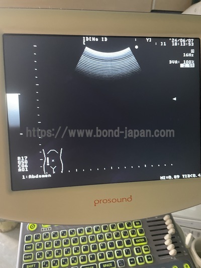 BW System&nbsp;|&nbsp;ALOKA&nbsp;|&nbsp;Prosound 6