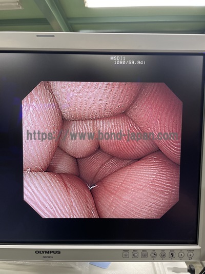 上部消化管汎用ビデオスコープ&nbsp;|&nbsp;オリンパス&nbsp;|&nbsp;GIF-1200Nの写真