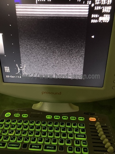 BW System&nbsp;|&nbsp;ALOKA&nbsp;|&nbsp;Prosound 6