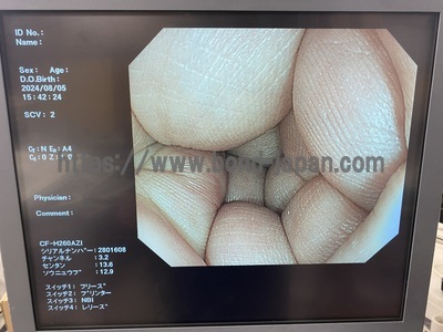 Endoscopy System&nbsp;|&nbsp;OLYMPUS&nbsp;|&nbsp;LUCERA CV-260SL