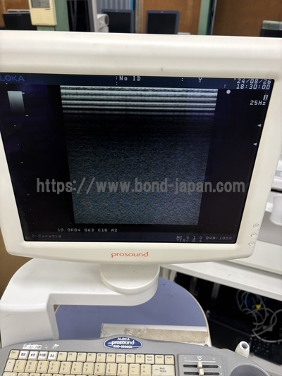 Color Doppler&nbsp;|&nbsp;ALOKA&nbsp;|&nbsp;SSD-3500SX