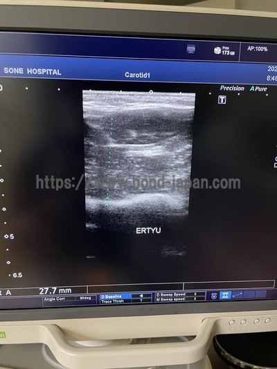 &nbsp;|&nbsp;CANON&nbsp;|&nbsp;TUS-X100S  Xario 100S