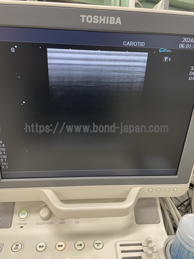 Color Doppler&nbsp;|&nbsp;CANON&nbsp;|&nbsp;SSA-590A Nemio MX