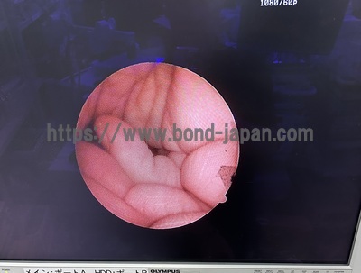 HD Camera Head&nbsp;|&nbsp;OLYMPUS&nbsp;|&nbsp;OTV-S7ProH-HD-L08E