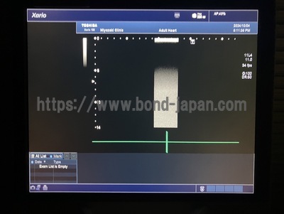 Color Doppler&nbsp;|&nbsp;CANON&nbsp;|&nbsp;TUS-X100 Xario 100