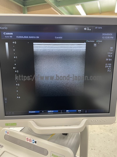 &nbsp;|&nbsp;CANON&nbsp;|&nbsp;TUS-X100S  Xario 100S