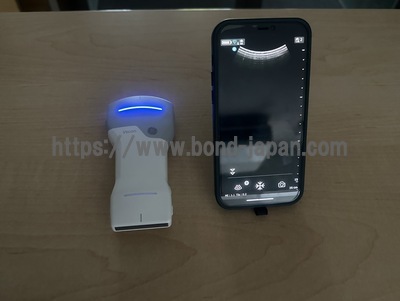 汎用超音波画像診断装置&nbsp;|&nbsp;GEヘルスケア・ジャパン株式会社&nbsp;|&nbsp;Vscan Air CLの写真