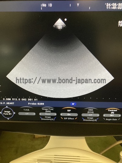 Color Doppler&nbsp;|&nbsp;HITACHI&nbsp;|&nbsp;F37