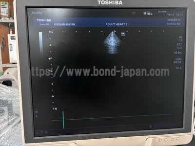 Color Doppler&nbsp;|&nbsp;CANON&nbsp;|&nbsp;Xario 200