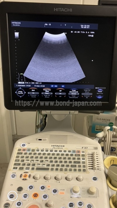 Color Doppler&nbsp;|&nbsp;HITACHI&nbsp;|&nbsp;F37