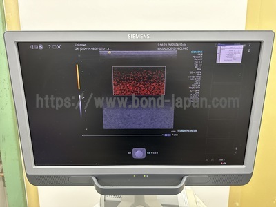 Ultrasound&nbsp;|&nbsp;SIEMENS&nbsp;|&nbsp;Acuson S1000 HELX