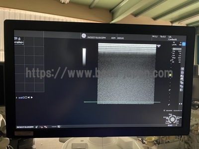 Ultrasound&nbsp;|&nbsp;GE&nbsp;|&nbsp;LOGIQ P9