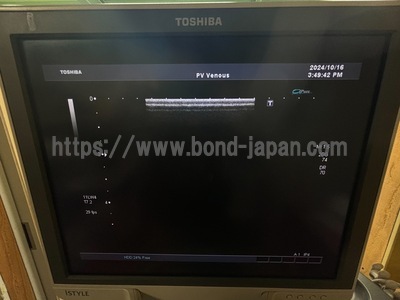 Color Doppler&nbsp;|&nbsp;CANON&nbsp;|&nbsp;SSA-680A Xario XG