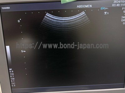 Color Doppler&nbsp;|&nbsp;CANON&nbsp;|&nbsp;SSA-590A Nemio MX