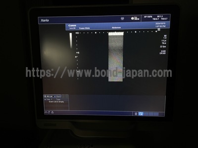 Color Doppler&nbsp;|&nbsp;CANON&nbsp;|&nbsp;Xario 200