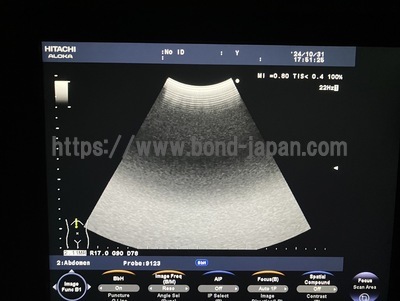 Color Doppler&nbsp;|&nbsp;HITACHI&nbsp;|&nbsp;F37