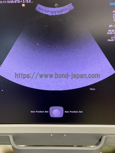 Ultrasound&nbsp;|&nbsp;SIEMENS&nbsp;|&nbsp;Acuson S1000 HELX