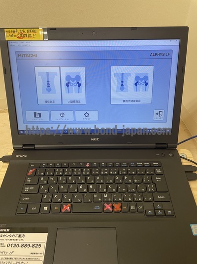 X線骨密度測定装置&nbsp;|&nbsp;富士フィルムヘルスケア株式会社&nbsp;|&nbsp;ALPHYS LFの写真