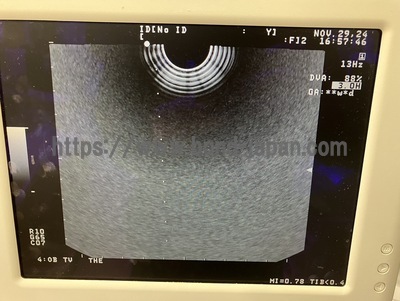 BW System&nbsp;|&nbsp;ALOKA&nbsp;|&nbsp;Prosound 6