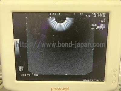 BW System&nbsp;|&nbsp;ALOKA&nbsp;|&nbsp;Prosound 6