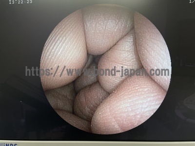 Endoscopy System&nbsp;|&nbsp;FUJIFILM&nbsp;|&nbsp;EPX-4400