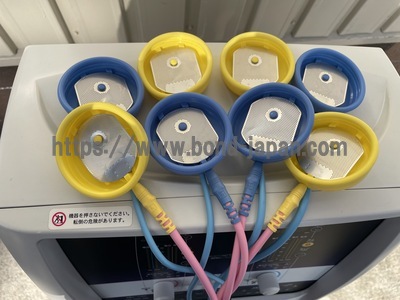 干渉電流型低周波治療器&nbsp;|&nbsp;ミナト医科学株式会社&nbsp;|&nbsp;SK-10Sの写真