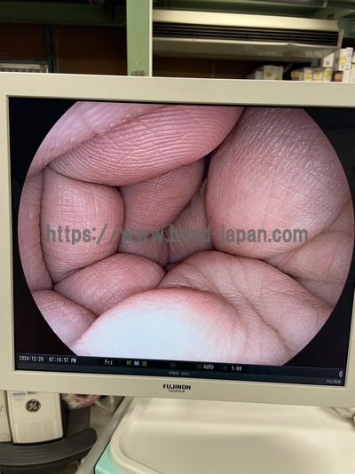 Video Gastroscope&nbsp;|&nbsp;FUJIFILM&nbsp;|&nbsp;EG-590WR2