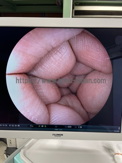Video Colonoscope&nbsp;|&nbsp;FUJIFILM&nbsp;|&nbsp;EC-590WM3